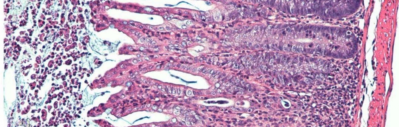 Inflamed Mouse Colon (Pink)